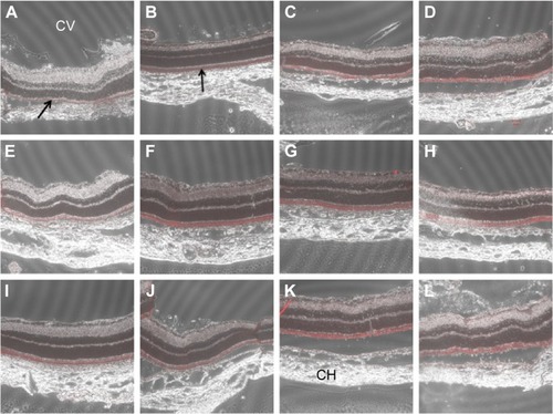 Figure 5 Confocal microscopy of the retina at 1 day (A, E, and I), 3 days (B, F, and J), 5 days (C, G, and K), and 7 days (D, H, and L) after intravitreal injection of Cy5-labeled micelles in rat. (A–D) Eyes injected with Cy5-labeled MPEG2000 Da-PCL2000 Da-g-PEI micelles. (E–H) Eyes injected with Cy5-labeled MPEG2000 Da-PCL6000 Da-g-PEI micelles. (I–L) A group of MPEG5000 Da-PCL2000 Da-g-PEI micelles. The fluorescent micelles diffused through the retinal layers and were concentrated in the RPE layer. Black arrows indicate this layer.Abbreviations: Cy, cyanine; MPEG, monomethoxy poly(ethylene glycol); PCL, poly(ε-caprolactone); PEI, polyethylenimine; CH, choroid; RPE, retinal pigment epithelium.