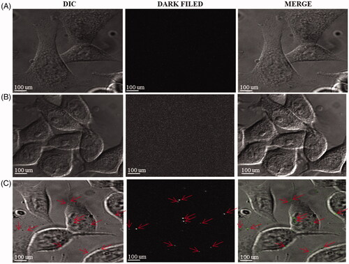Figure 10. Detection of intercellular DCY51T-AuCKNps in the stomach cancer cell lines (AGS). (A) Control sample, (B) 800 nm laser treatment for 10 min. (C) DCY51T-AuCKNps + laser at 800 nm for 10 min.
