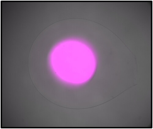 Figure 5. Fluorescent payload is captured only in the region with free radicals. Agar beads were imaged in brightfield using the 4× objective of a microscope, and the entire bead is within the image frame. Irgacure and first-phase polymers were delivered, and the center of the bead was exposed to UV light (20× objective) to generate radicals. Cy5-DBCO was delivered after washing, and beads were re-washed to remove unreacted Cy5-DBCO. Fluorescence was only detected in the center of the bead, corresponding to the region where free radicals were generated. This demonstrates that capture net formation is specific and local to areas with high levels of free radicals.