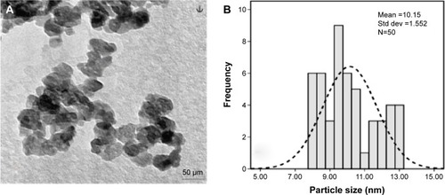 Figure 3 Morphological characteristic of HA/ZnO nanocomposite.