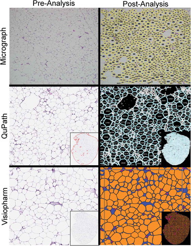 Figure 1. Screenshots of adipocyte tissue images pre- and post-analysis
