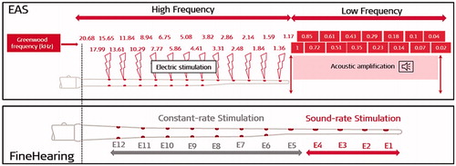 Figure 10. Illustration of EAS and FineHearing™ concept. EAS provides acoustic amplification of the functional LF region using hearing aids, and electric stimulation of the HF deaf region using a CI electrode array. FineHearing™ concept provides sound-rate stimulation (electric stimulation in synchrony with the sound rate) to the apical electrode channels that are physically placed well beyond the basal turn of the cochlea to have a place match and constant-rate stimulation to the basal electrode channels (image courtesy of MED-EL).