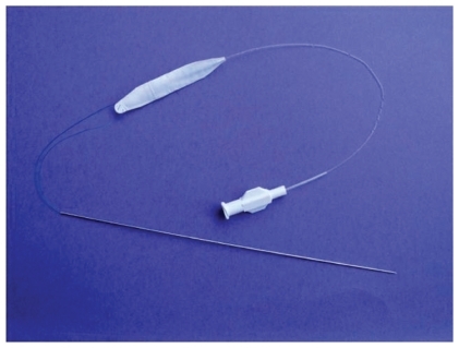 Figure 2 Subcutaneous volumizer Fulfil implant prior to placement. Guide needle and fill tube shown. Implant is inflated with saline to expand surrounding soft tissue.