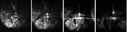 Figure 2. Temporal sequence of image frames porcine experiment.