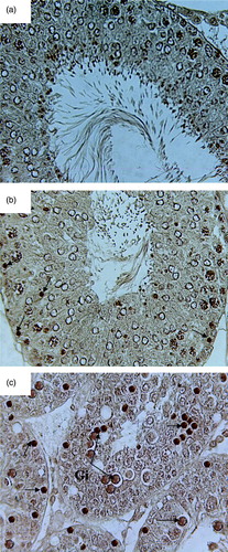Figure 5.  Microphotograph of TUNEL staining after 4 weeks for control, pairfed, and zinc deficient groups. Note: 400X. (A) Microphotograph of testes of 4ZC group exhibiting negative TUNEL staining in all the germ cells. (B) Microphotograph of testes of 4PF group showing few TUNEL positive cells (arrows). (C) Microphotograph of testes of 4ZD group revealing increase in the number of apoptotic cells. Positive staining seen in spermatogonia, primary spermatocytes, and giant cells (Gi) (cap-phase spermatids) (arrows).