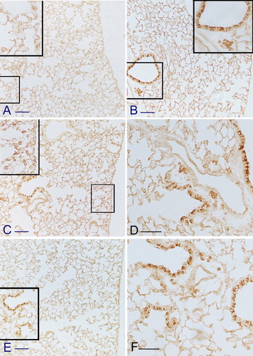 Figure 7. Immunohistochemical reaction for arginase 1 in smoking mice at 5 months from the start of the treatment. DBA/2 show a strong positivity for arginase 1 both in peripheral (C) and peribronchiolar areas (D) of their lungs. Similarly, in p66 deficient mice a consistent number of arginase 1 positive cell is found in peribronchiolar areas (E). (F) is higher magnification of (E). Few numbers of macrophages showing positivity for such an enzyme is found in C57 Bl/6J (B), or Lck deficient mice. No reaction is observed in macrophages from ICR mice (A). Scale bars: (A–C) =100 µm; (D–E) = 50 µm.
