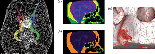 Figure 8. The use of radial and path-based distance to convert “distant” extra-cranial soft tissue to tissue of null displacement and determine edge scale: (a) original tissue map Citation[6]; (b) null-displacement tissue (in orange); (c) final wireframe and rendering of triangulated surface, with dense results visible within 10 mm of the path. [Color version available online.]
