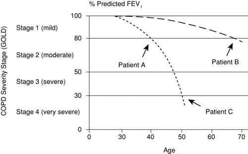 Figure 2.  Severity staging and natural history of COPD.44 Grouping by FEV1 would put together patient A (40 years old with a rapid rate of decline) and patient B (70 years old with a slower rate of decline). Conversely, patients of different ages with rapid disease progression (patients A and C) may have more features in common than patients with the same FEV1 percent of predicted and different rates of progression. Abbreviations: COPD, chronic obstructive pulmonary disease; FEV1, forced expiratory volume in 1 sec; GOLD, Global Initiative for Obstructive Lung Disease. Reprinted from Rennard SI, Vestbo J. Natural histories of chronic obstructive pulmonary disease. Proc Am Thorac Soc 2008 Dec 15; 5(9):878–883, with permission of the American Thoracic Society. Copyright © 2012 American Thoracic Society. An official publication of the American Thoracic Society.