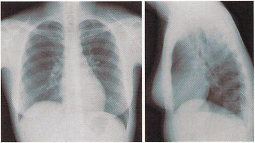 Figure A.2. Chest X-ray (case 3).