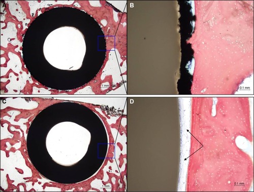 Figure 11 Histology results at 24 weeks for a representative Ti-PEEK implant (A, B) compared to an uncoated PEEK implant (C, D).