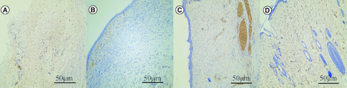 Figure 6. Effect of human umbilical cord mesenchymal stem cells combined with small porcine intestinal submucosa on wound microvessel density (CD31, ×200 magnification).(A) Blank control group. (B) Small porcine intestinal submucosa group. (C) Human umbilical cord mesenchymal stem cell group. (D) Human umbilical cord mesenchymal stem cells combined with small porcine intestinal submucosa group (scale bar = 50 μm).