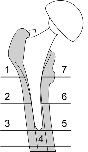 Figure 1. Gruen zones used in DXA analysis of periprosthetic BMD.