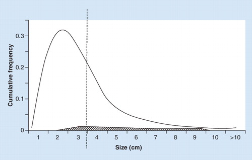 Figure 1. Frequency distribution of adrenal incidentalomas by size (cm); incidentally discovered pheochromocytomas are shown in hatched area.The dotted line at 3 cm illustrates that at ≤3 cm the prevalence of pheochromocytoma is only 2%, whereas at >3cm the prevalence is 8.3%.Data taken from Citation[25].