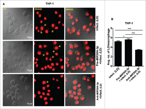 Figure 5. Expression of MIR30A-3p influences intracellular burden of Leishmania parasites in THP-1 cells. (A) THP-1 differentiated macrophages were transfected with the MIR30A-3p mimic or the MIR30A-3p inhibitor for 48 h followed by infection with promastigotes of L. donovani (MOI of 10). Cells were fixed and subsequently stained with fluorescent nucleic acid probe, DRAQ5. Confocal microscopy was performed to assess the parasite burden. The image is a representative field among multiple random fields analyzed for scoring average parasite number per macrophage from a minimum of 100 infected cells counted from at least 10 fields. Arrows indicate infected parasites, scale bars: 10 μm for 63x images. Bar diagram showing average number of parasites per THP-1 cells (B). To assess the parasite burden, at least 100 macrophages were counted for the number of parasites in each condition of manipulation. The statistical significance was determined by using the Student t test (***, P < 0.001; **, P < 0.01; *, P < 0.05). LD, Leishmania donovani.
