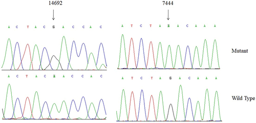 Figure 6 Identification of m.A14692G and m.G7444A variants by direct sequencing analysis.