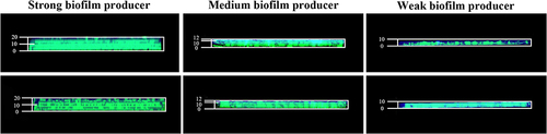 Figure 6 CLSM images assessing the diffusion of gatifloxacin through biofilms of three representative isolates. The biofilms were stained with SYTO 9 to visualize biofilm (green); the intrinsic fluorescence of gatifloxacin appeared blue.