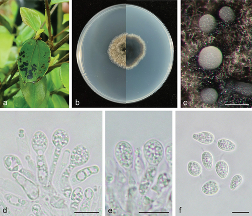 Figure 3. Phyllosticta jiangxiensis (holotype, CAF 8000202). a: Leaf lesions on living leaf of Camellia oleifera; b: Colonies (left-above, right-reverse) after 7 days on PDA; c: Conidiomata; d, e: Conidiogenous cells with conidia; f: Conidia. Scale bars: 200 μm (c); 10 μm (d–f).