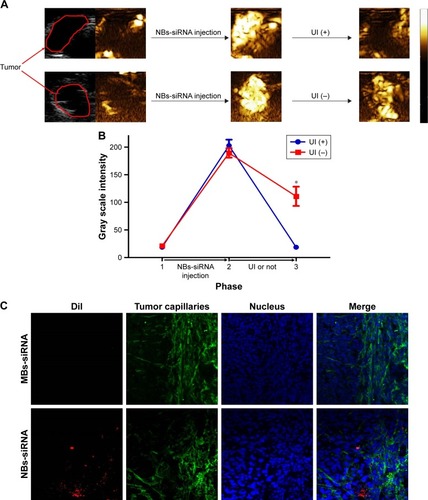 Figure 7 UI-targeted destruction effect on NBs-siRNA and NBs-siRNA distribution in tumor tissue. (A) Contrast enhancement images of NBs-siRNA with or without UI. (B) Corresponding phase-intensity curves analyzed with data extracted from (A). (C) CLSM images of frozen sections. Blue: nuclei; Green: capillary; Red: DiI-labeled NBs-siRNA. DiI-labeled NB-siRNA are observed in the intercellular space and outside the capillaries (top), whereas DiI-labeled MBs are hardly visible outside the tumor capillaries (bottom). *P<0.05.