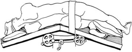 Figure 2 Diagram of the kidney position.