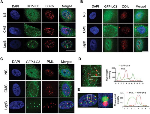 Figure 4. LC3 interacts with PML nuclear bodies in LepB-treated cells, but not with CMS-induced ones. hTM cells were transduced with AdGFP-LC3 (5 pfu/cell) and either exposed to CMS (8% elongation) or LepB (20 nM) treatment for 24 h. Cells were fixed and immunostained with specific antibodies against nuclear speckels (A), Cajal bodies (B) and PML bodies (C). Fluorescent intensity of GFP-LC3 signal (green) and PML (red) in CMS (D) and LepB-treated cells (E) were quantified with Fiji software. DAPI was used to stain nuclei. Scale bars: 20 μm.