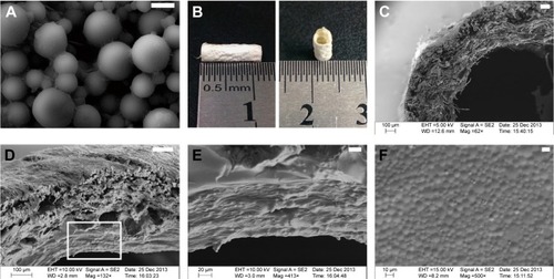 Figure 2 Macroscopic and microscopic morphology of bilayer collagen conduit filled with GelMA hydrogels of GDNF-loaded microspheres.Notes: (A) GDNF-loaded gelatin microspheres were observed by scanning electron microscope. (B) Macroscopic morphology of bilayer collagen conduit fabricated with bilayer collagen membrane. (C) Bilayer collagen conduit showing the layered structures in SEM. (D–F) SEM observations of bilayer collagen conduit filled with GelMA hydrogels of GDNF-loaded microspheres. (E) Magnified views of the square area in (D). (F) The surface morphology of GelMA hydrogel mixed with GDNF-loaded gelatin microspheres (bar in (A) =4 μm; bar in (C) =100 μm; bar in (D) =100 μm; bar in (E) =20 μm; bar in (F) =10 μm).Abbreviations: GelMA, gelatin-methacrylamide; GDNF, glial cell-line derived neurotrophic factor; SEM, scanning electron microscopy.