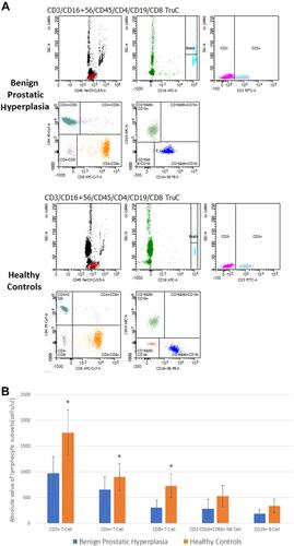 Figure 3 The absolute value of lymphocyte subsets in peripheral blood of each group. [(A) Flow cytometric results of lymphocyte subsets. (B) Histogram results of lymphoid subsets (*Comparison with the group of healthy controls (P<0.05)].