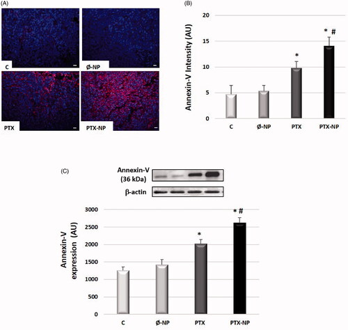 Figure 4. PTX-loaded nanoparticles induce apoptosis in HNSCC in vivo model. Treatment groups: C (control); Ø-NP (unloaded NPs, 1 mg/ml; PTX (Paclitaxel, 5 mg/kg); and PTX-NP (Paclitaxel loaded NPs, 5 mg/kg) for 21 days. (A) Representative immunostaining of annexin V in tumor tissue. The cytoplasm shows annexin-positive staining (red) characteristic of apoptotic cells (x40). Scale bar 100 mm. (B) Representative western blot of annexin-V protein expression levels and densitometric analysis. β-actin was used as a loading control. Data represent the mean ± SD of arbitrary units (AU). *p < .05 versus C and Ø-NP groups; #p < .05 versus group PTX. (n = 20).