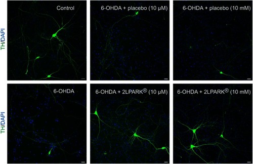 Figure 4 Representative pictures of DAergic neurons staining with TH antibody (green) and DAPI (blue). All images presented at ×20 magnification. Scale bar=30 μm.