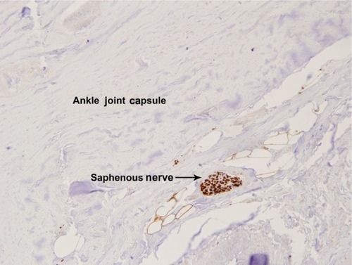 Figure 4 Photograph of histologic slide of saphenous nerve in the periosteum, 40×.