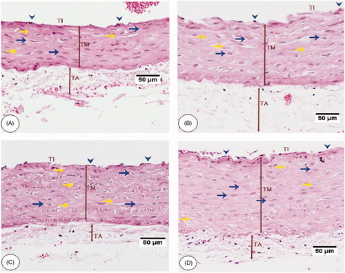 Figure 7. Aorta histopathology of high-fat diet (HFD) treated rats. (A) was taken from an HFD diet-fed rat co-treated with C. aronia (STD + C. aronia). (B) was taken from an HFD-fed rat post-treated with C. aronia. (C) was taken from an HFD-fed rat post-treated with SIM. These sections showed intact endothelial cells lining the tunica intima (TI) (blue arrowheads), horizontally oriented SMCs of tunica media (TM) toward the aortic canal (blue arrows). Also, well-formed elastic fibres were displayed in a lamellar pattern in its TM (yellow arrows) with marked decreases in the thickness of TM and TA. (D) was taken from an HFD-fed rat post-treated with SIM and shows similar findings like those observed in HFD-fed rats including disturbance and proliferation of tunica TI layer, the disorientation of SMCs with unclear borders and loss of elastic lamellae architecture. H&E, 200×.