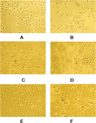 Figure 2.  Morphological changes in MCF-7 cells incubated for 48 h, (A) negative control (B) with 5 µM concentration of compound TS10, morphological changes in Hep-G2 cells incubated for 48 h, (C) negative control (D) with 5 µM concentration of compound TS10, morphological changes in MG-63 cells incubated for 48 h, (E) negative control (F) with 5 µM concentration of compound TS10. The cells were observed under phase contrast microscope 100×.
