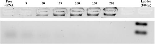 Figure 3. Agarose gel retardation assay of MSN-APTES-chitosan to STAT3 siRNA, complexed at different nanoparticle to nucleic acid (N/P) ratios.