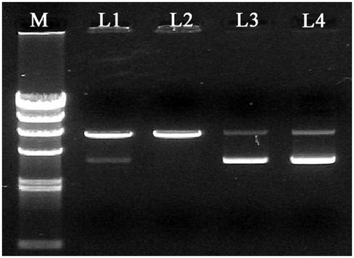 Figure 2. Representative agarose gel electrophoresis image following restriction digestion of the recombinant c-Myc-siRNA-pDNAs: M, DNA marker; L1, c-Myc-siRNA3-pDNAs cut by BamHI; L2, c-Myc-siRNA3-pDNAs cut by HindIII; L3, empty vector; L4, c-Myc-siRNA3-pDNAs.