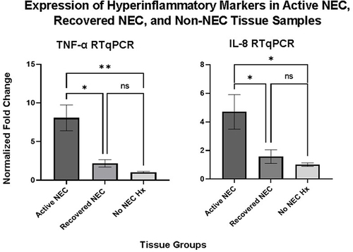 Figure 1 Expression of TNF-α and IL-8 in active NEC, recovered NEC, and non-NEC snap frozen tissue samples on RTqPCR. There is a significant difference seen in both TNF-α and IL-8 expression when comparing active NEC tissue to recovered NEC tissue (p=0.014 TNF-α and p=0.049 IL-8) and to non-NEC tissue (p=0.006 TNF-α and p=0.031 IL-8). There is no significant difference seen when comparing recovered NEC tissue to non-NEC tissue (p=0.701 TNF-α and 0.861 IL-8). (*Denotes significance, with increasing number of *Denoting increased significance; ns denotes no significance).