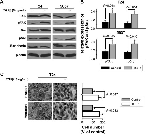 Figure 2 Effect of TGFβ on FAK phosphorylation and migratory and invasive potential of bladder cancer cells.