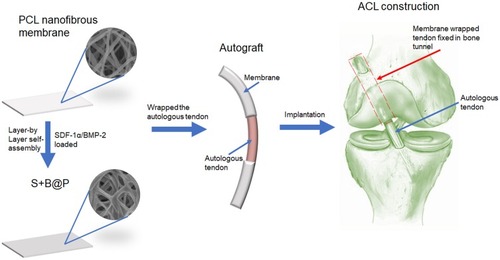 Figure 1 Schematic illustration of the fabrication of nanofibrous membrane, and the implantation of the membrane-wrapped autograft tendon into femur and tibia bone in ACL reconstruction surgery.Abbreviations: SDF-1α, stromal derived factor-1α; BMP-2, bone morphogenetic protein-2; ACL, anterior cruciate ligament.