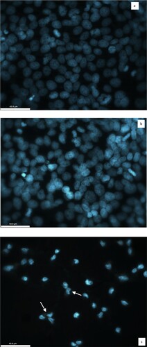 Figure 8. Representative confocal imaging of HeLa cells stained with Hoechst-33342. (a) HeLa cells in the absence of CL and CL/ZnO NPs (control) (b) HeLa cells treated with the IC50 concentration of CL for 48 hours (c) HeLa cells treated with the IC50 concentration of CL/ZnO NPs for 48 hours. The morphology of HeLa cells showing the cytotoxic effect of CL/ZnO NPs. The white arrows denote small or fragmented nuclei and shrunken cytoplasm (43.9 µm).