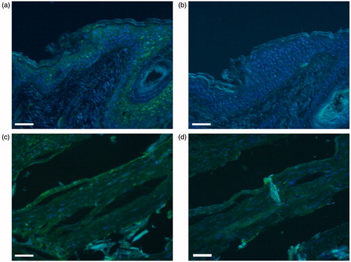 Figure 1. Photomicrographs of fluorescence immunohistochemical staining for TRPV1. The panels show positive staining/negative control pairs of the postauricular skin (a/b) and cholesteatoma tissue (c/d). Green and blue colors express the fluorescence of Alexa Flour 488 and DAPI, respectively. Weak fluorescence is seen in the granular and spinous layers in the skin, but there is no significant fluorescence in cholesteatoma. Scale bar = 50 μm.