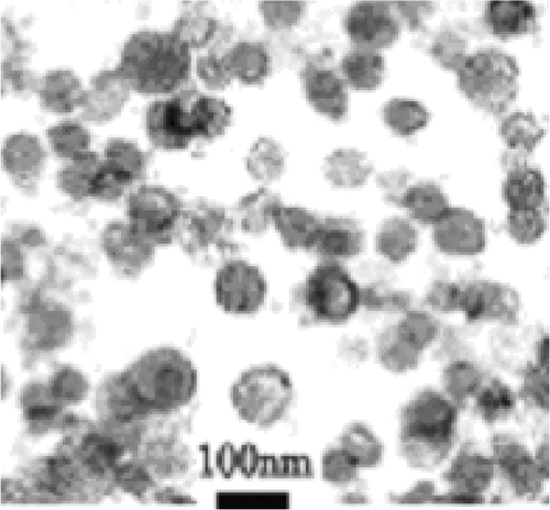 Figure 1. Identification of exosomes. A representative image from one sample (patient 1) of electron microscopy performed on exosome preparations showing bilayer membranes that range in size from 40–90 nm. Bar = 100 nm.