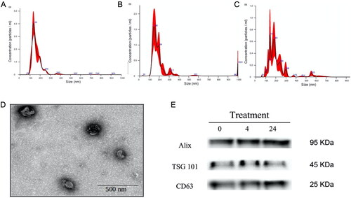 Figure 2. Characterization of extracellular vesicles secreted by at-MSC and isolated from culture media. A to C, histograms of nanoparticle tracking analysis at time zero, 4, and 24h respectively, size is indicated on the X-axis, and concentration on the Y-axis. D: representative image from TEM showing the morphology of EV. E: Bottom right: Western blot analysis of selected EV markers, molecular weight is displayed.