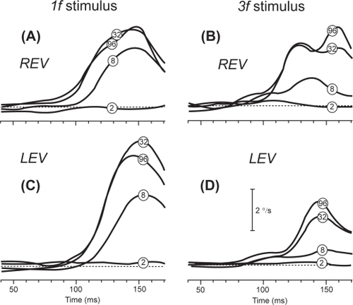 Figure 2 Representative mean right-left velocity profiles of the ocular following responses (OFR) versus time elicited in a patient with MS who had partially recovered from a left optic neuritis. The patient responded to successive ¼-wavelength shifts applied to 1f stimuli (left column) and 3f stimuli (right column) of different contrast (contrast of the pattern is shown by encircled numbers superimposed on traces). A and B: right-eye-viewing sessions (REV). C and D: left-eye-viewing sessions (LEV). Note the smaller LEV responses to the 3f stimuli versus 1f stimuli. Adapted from (CitationRucker et al 2006).