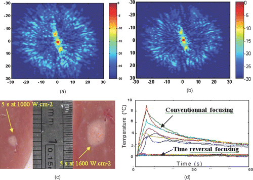 Figure 4. Spatial directivity pattern of the transcostal ultrasonic beam in the focal plane using (a) conventional focusing and (b) time reversal focusing. (c) Necrosis obtained using time reversal focusing through the rib cage in liver samples for a 5-s duration at 1000 W cm−2 and for a 5-s duration at 1600 W cm−2. (d) Temperature elevation at several locations on the rib cage with conventional and time reversal focusing. The temperature elevation is estimated using implanted thermocouples (Ironconstantan, 40 µm diameter, PhysiTemp Corp.).