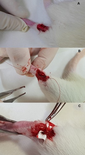 Figure 1 (A) Exposing the Achilles tendon, (B) suturing the tendon with sutures, and (C) enveloping the tendon with doxycycline-loaded nanofibrous membrane.