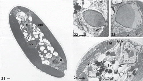 Figs 21–24. TEM sections of Characiopsis vegetative cells. Fig. 21. C. minuta ACOI 2423. Figs 22–24. C. cf. saccata ACOI 481. Chloroplast (chl), Golgi body (G b), lamellate vesicles (l v), mitochondrion (m), nucleus (n), nucleolus (nu), pyrenoid (py), reddish globule (r g). Scale bars: 1 μm