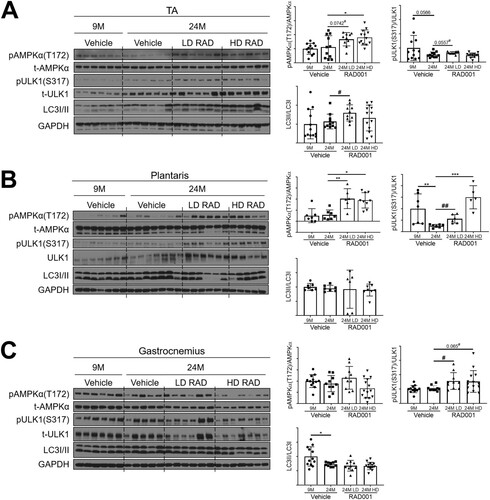 FIG 7 Low-dose rapalog treatment may reestablish autophagy in sarcopenic rats. Representative immunoblots are shown for phosphorylated (p) and total (t) protein for AMPKα, ULK1, and LC3I/II in tibialis anterior (A), plantaris (B), and gastrocnemius (C) muscles of 9- and 24-month-old rats treated with vehicle and 24-month-old rats treated with 0.15 mg/kg (LD) or 0.5 mg/kg (HD) RAD001. Glyceraldehyde-3-phosphate dehydrogenase (GAPDH) is shown as a protein loading control. Phosphorylated protein amounts were quantified relative to the respective total protein amounts by densitometry (n = 6 to 13 animals per group). LC3II protein amounts were quantified as a ratio relative to LC3I protein amounts. Data are means ± standard deviations of the means. Asterisks are used to denote significance as follows: *, P < 0.05; **, P < 0.01; ***, P < 0.001. Pound signs are used to denote significance as follows: #, P < 0.05; ##, P < 0.01 (by unpaired Student’s t test). y-axis data represent arbitrary units.
