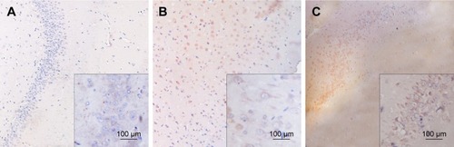 Figure 3 Expression of NGF-positive cells in the hippocampal CA3 region in the three groups (IHC staining, 400×): (A) control group; (B) 5-Hz EA group; and (C) 50-Hz EA group.