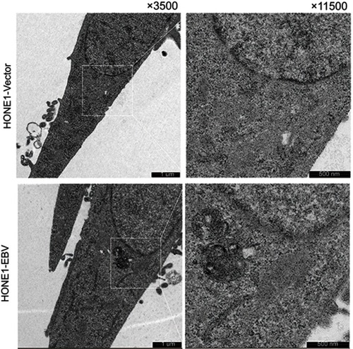 Figure S2 Transmission electron microscopy of HONE1-Vector and HONE1-EBV cells observed no virus particles.