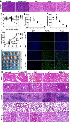 Figure 5 Antitumor effect of DFZ. (A and H) The H&E is staining images of the tumor and normal organs from mice after treatment with saline as control (G1), Fe3O4@ZIF-8 (G2), free DOX (G3), DFZ (G4), and DFZ+MF (G5). (B and C) Body weight and Tumor volume changes in the mice after treatment. Error bars indicate the SD (n = 5). (D) An image of the tumor at the end of the experiment. (E) Weight, and (F) Volume of tumor tissue. (G) Immunohistochemical (TUNEL) analyses of tumor tissue sections from mice treated with DFZ and processed with /without magnetic field. The statistical data are represented as the mean ± SD.