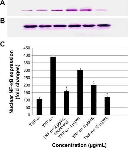 Figure 12 Western blot analysis of NF-κB in koenimbin-treated PC-3 cells and control.
