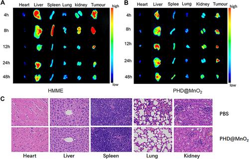 Figure 6 In vitro biodistribution and biocompatibility. (A) Fluorescence images of isolated organs and tumors at different time point after HMME injection. (B) Fluorescence images of isolated organs and tumors at different time point after PLGA-HMME-DTX@MnO2 injection. (C) H&E staining sections of organs after PLGA-HMME-DTX@MnO2 treatment.